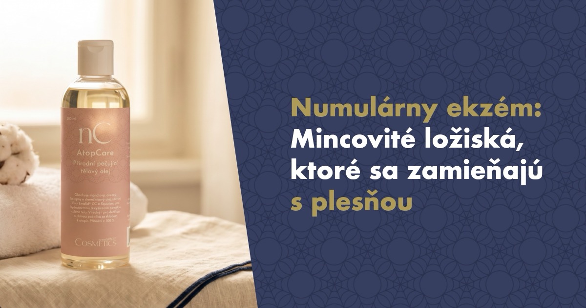 Numulárny (diskoidný) ekzém: Mincovité ložiská, ktoré sa zamieňajú s plesňou