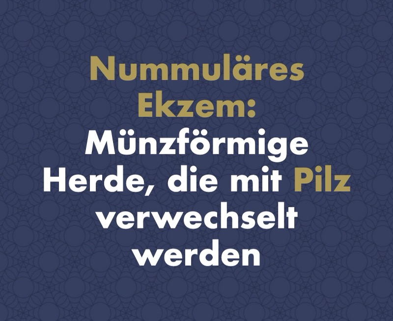 Nummuläres (diskoides) Ekzem: Münzförmige Herde, die mit Pilz verwechselt werden