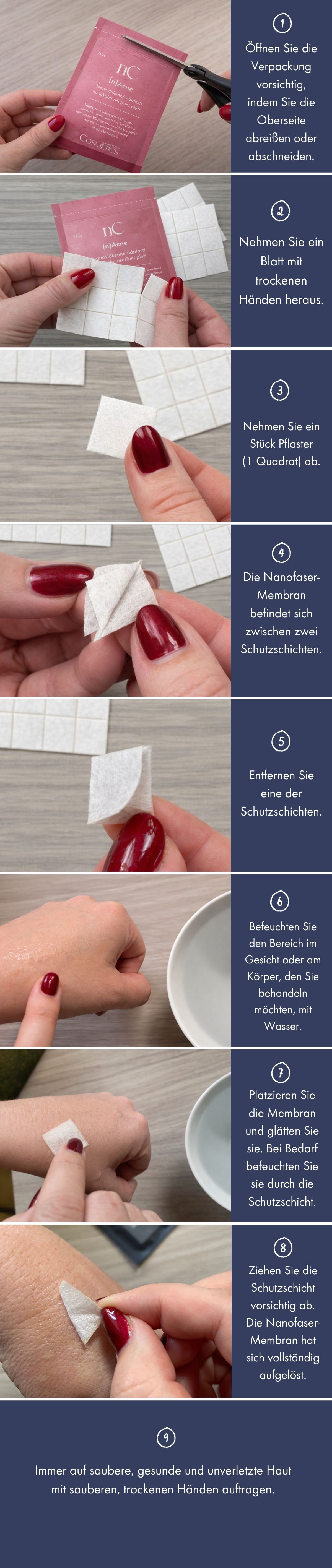 Fotoanleitung-n-acne