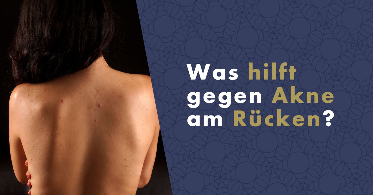 akne-am-rucken-fb