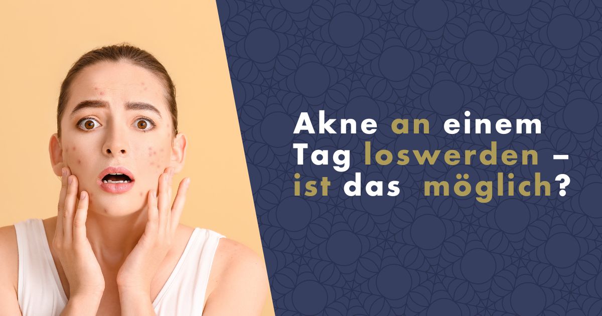 akne-an-einem-tag-loswerden-ist-das-moglich-fb