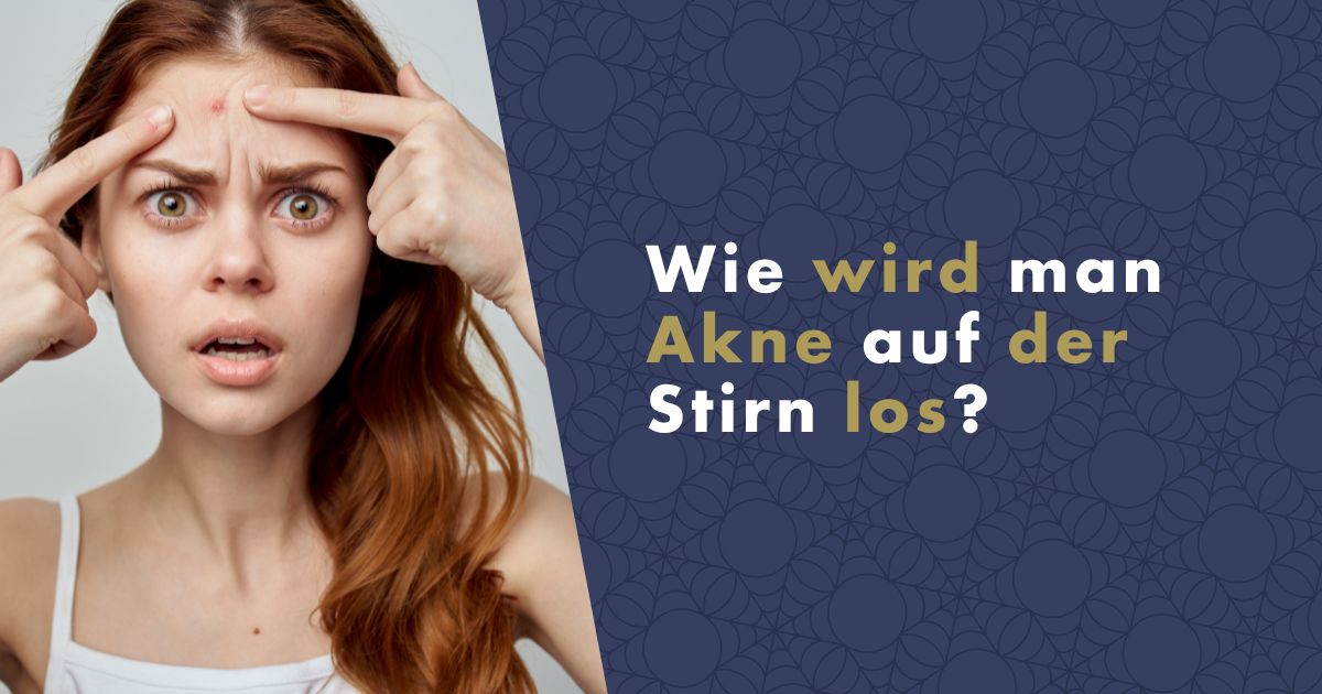 akne-auf-der-stirn-fb