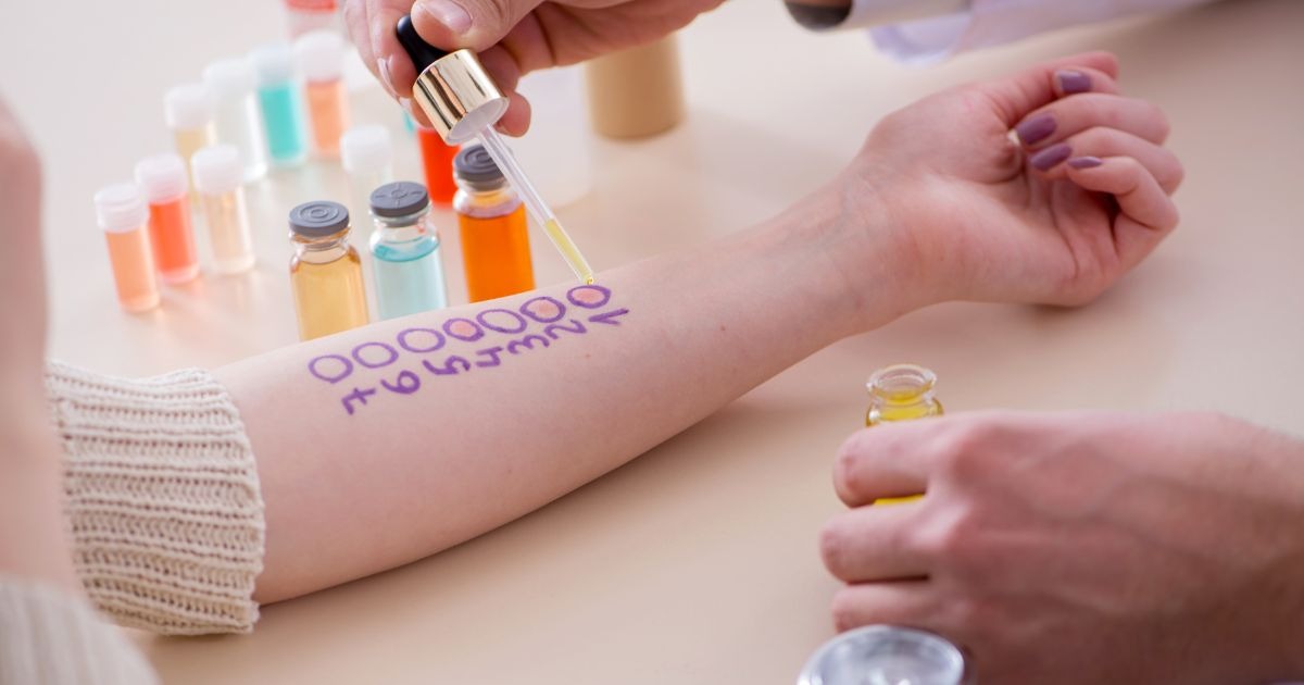 allergie-test-reaktionen