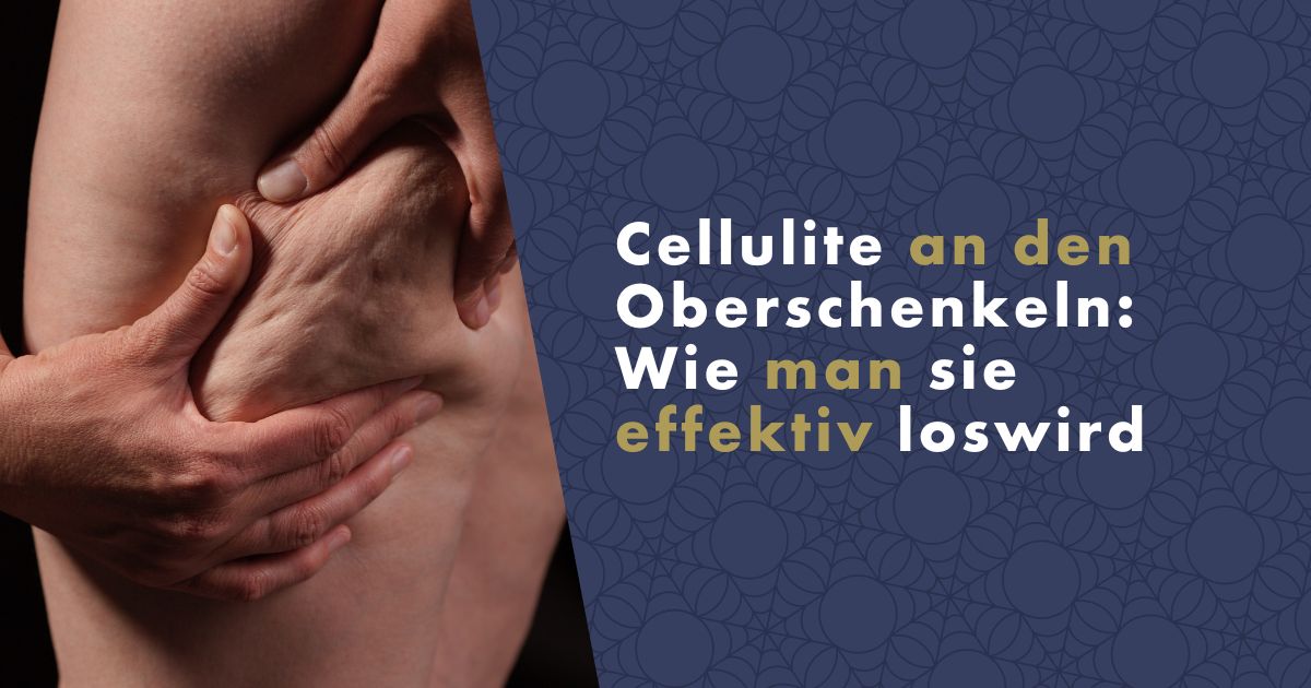 cellulite-an-den-oberschenkeln-fb