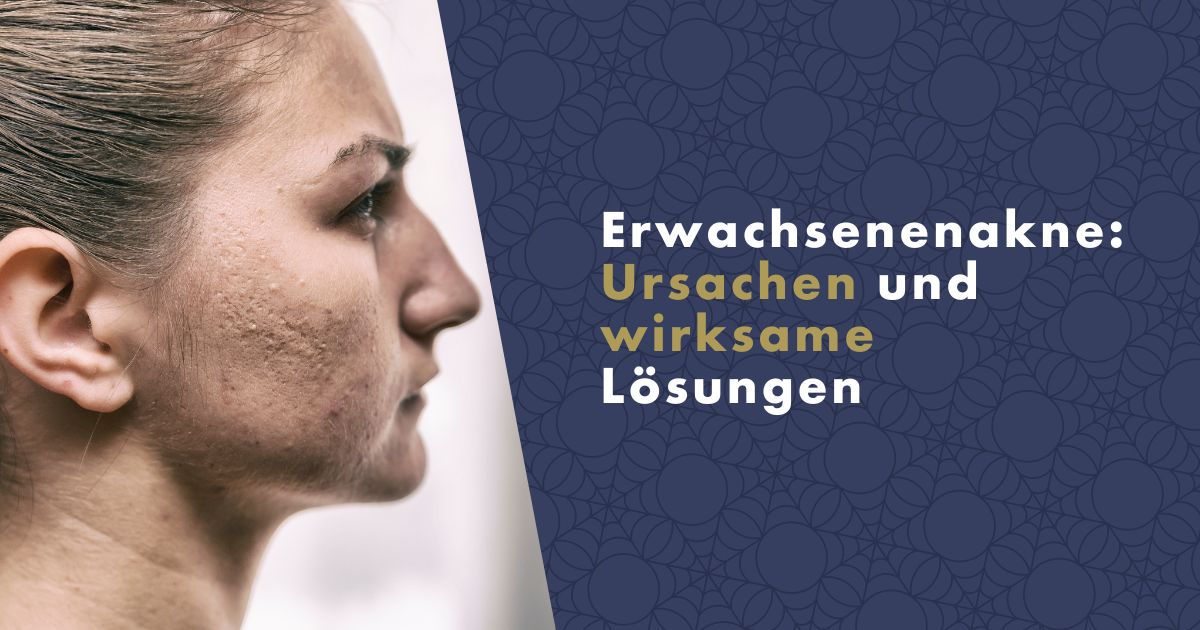 erwachsenenakne-fb