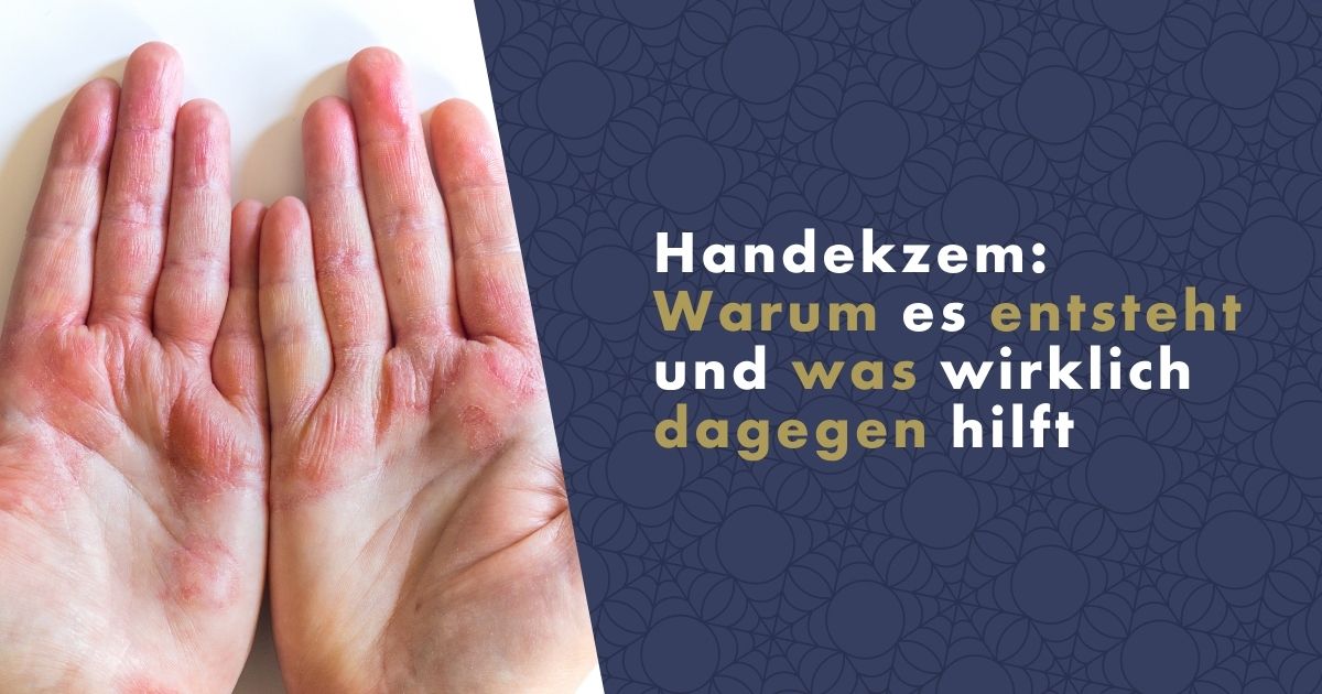 handekzem-fb