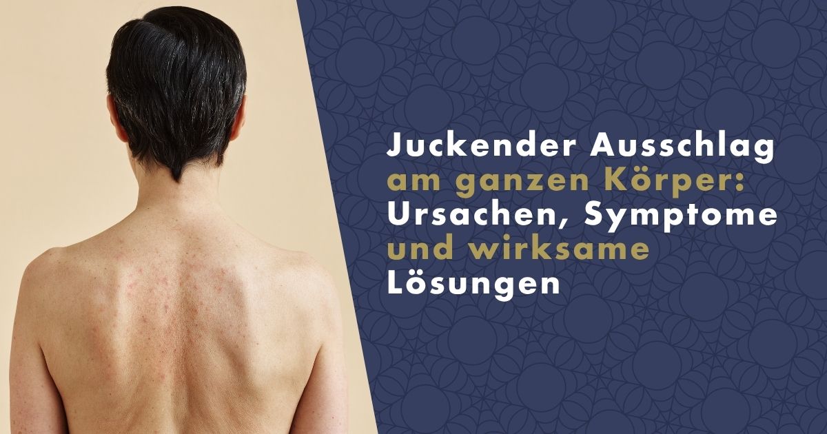 juckender-ausschlag-am-ganzen-korper-fb