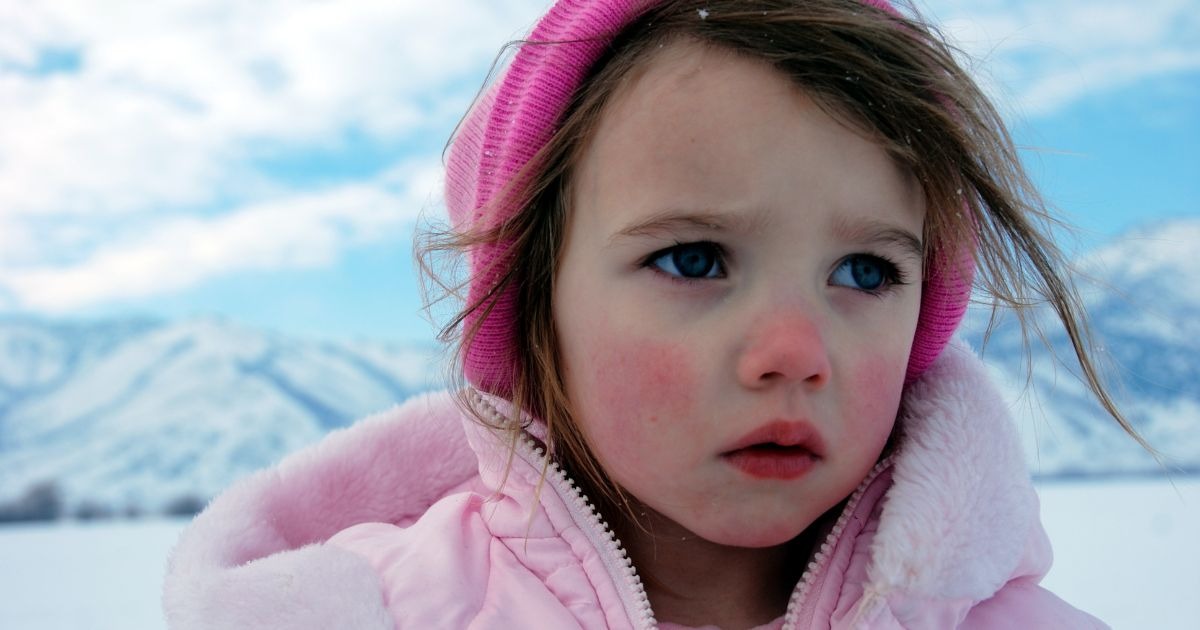 kalteallergie-bei-kindern