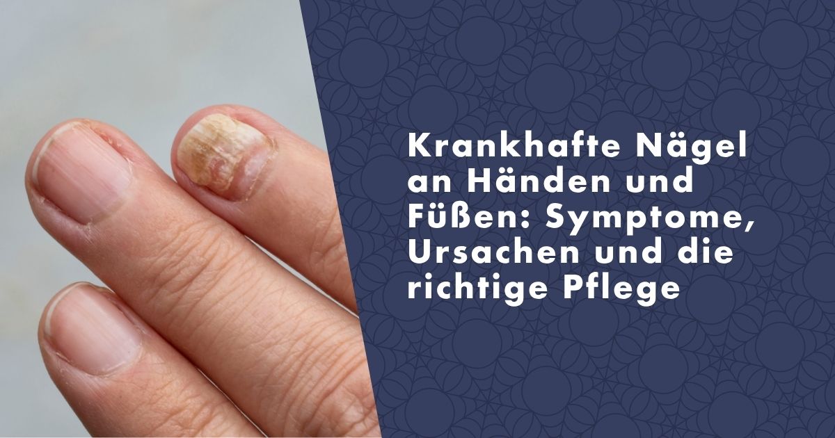 krankhafte-nagel-an-handen-und-fussen-fb