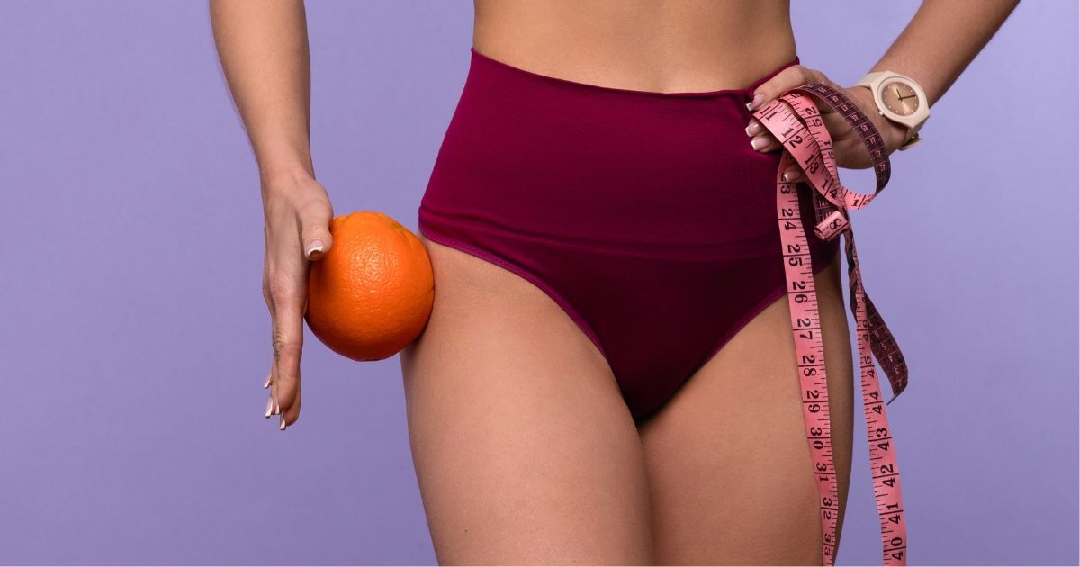 orangenhaut-cellulite