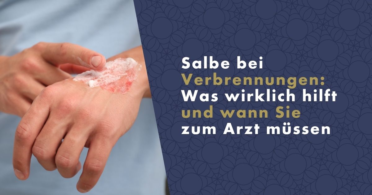 salbe-bei-verbrennungen-fb