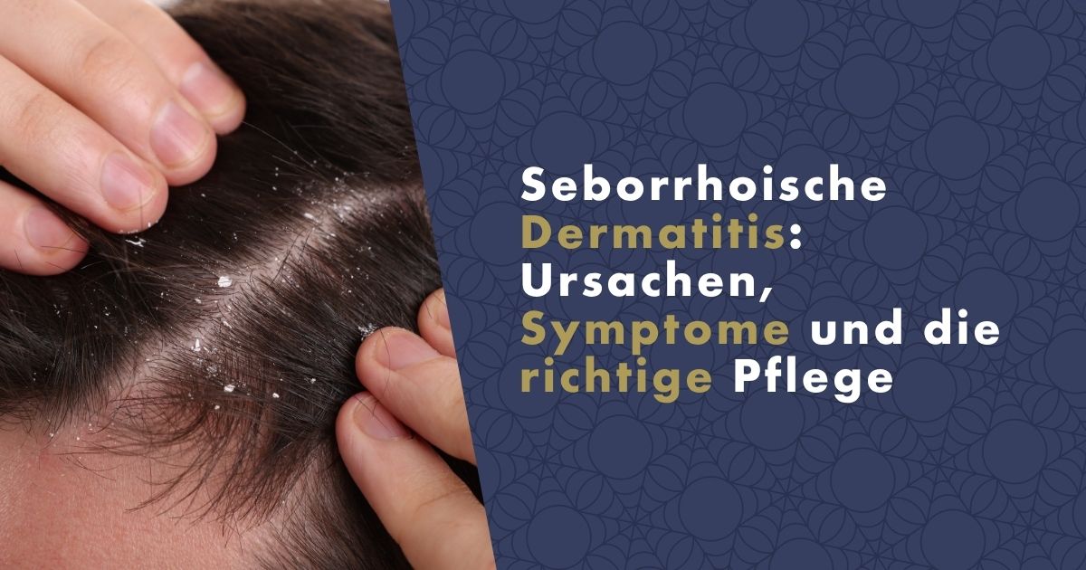 seborrhoische-dermatitis-fb
