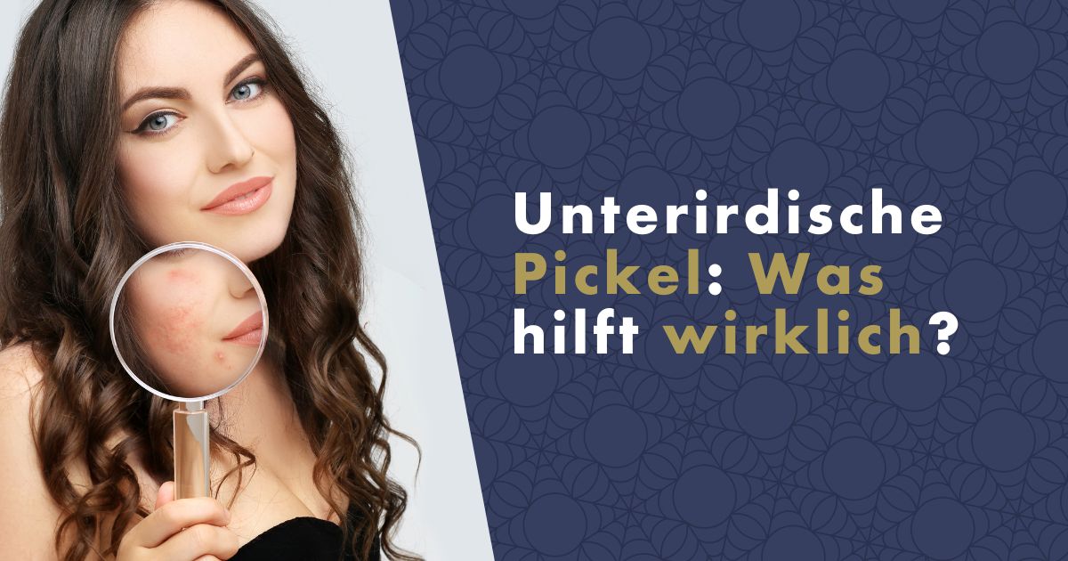 unterirdische-akne-fb