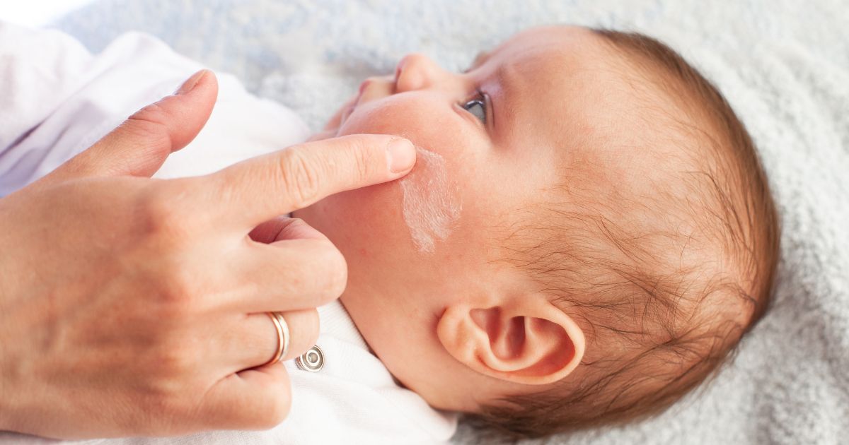 was-ist-atopisches-ekzem-bei-kindern