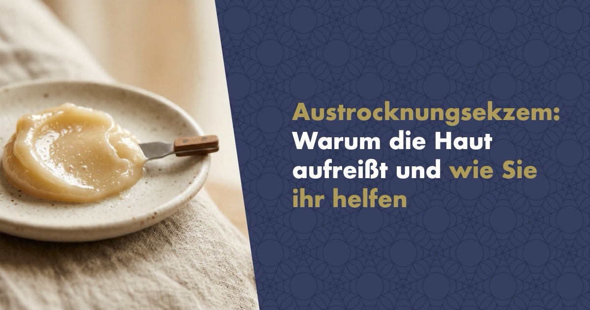Austrocknungsekzem: Warum die Haut wie ein ausgetrocknetes Flussbett aufreißt und wie Sie ihr helfen