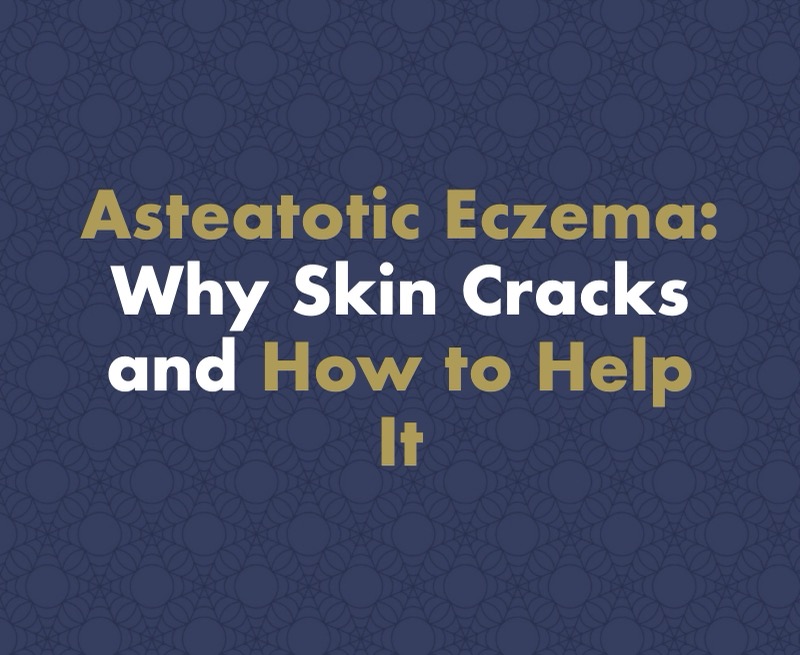 Asteatotic Eczema: Why Skin Cracks Like a Dried Riverbed and How to Help It