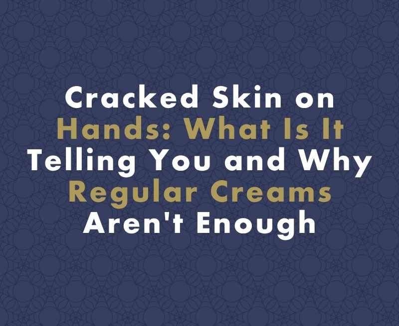 Cracked Skin on Hands: What Your Body Is Telling You and Why Regular Creams Aren't Enough