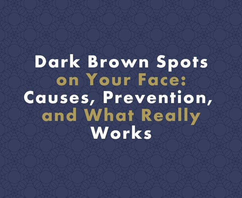How to Treat Dark Brown Spots on Your Face: Causes, Prevention, and What Really Works