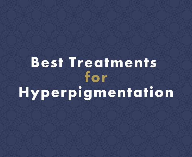 Best Treatments for Hyperpigmentation