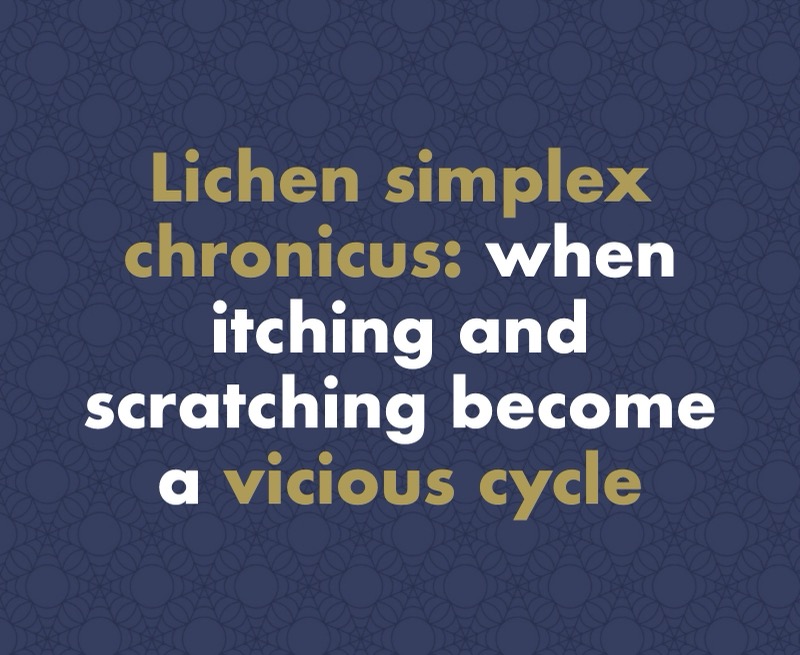 Lichen Simplex Chronicus (Neurodermatitis): When Itching and Scratching Become a Vicious Cycle