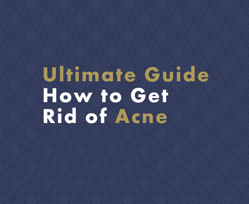 Ultimate Guide: How to Get Rid of Acne