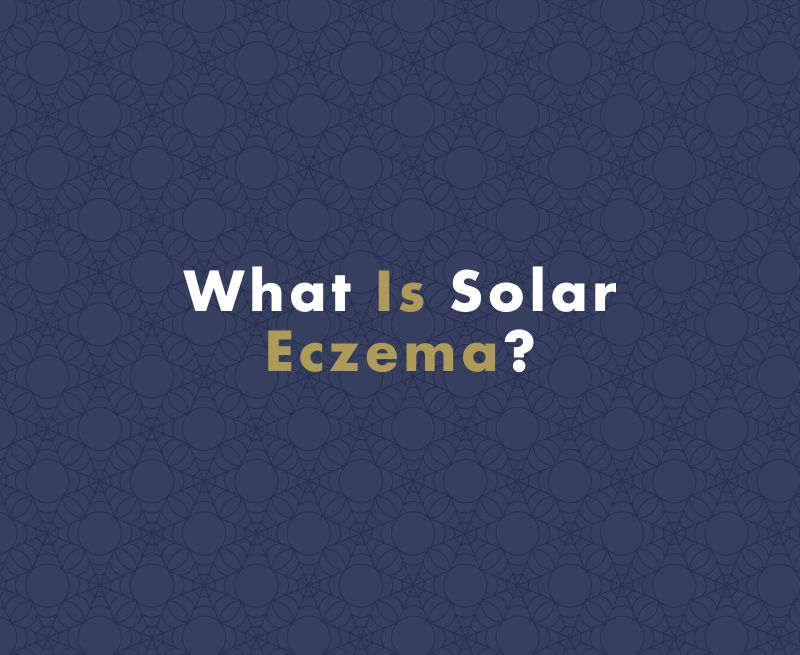Solar Eczema (Solar Dermatitis): Causes, Symptoms, and Treatment