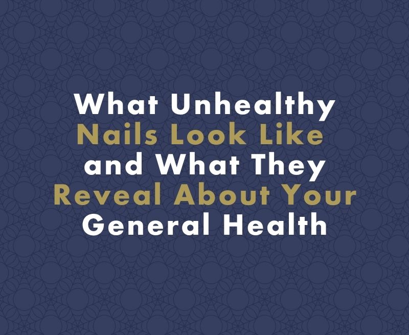 What Unhealthy Nails Look Like and What They Reveal About Your General Health