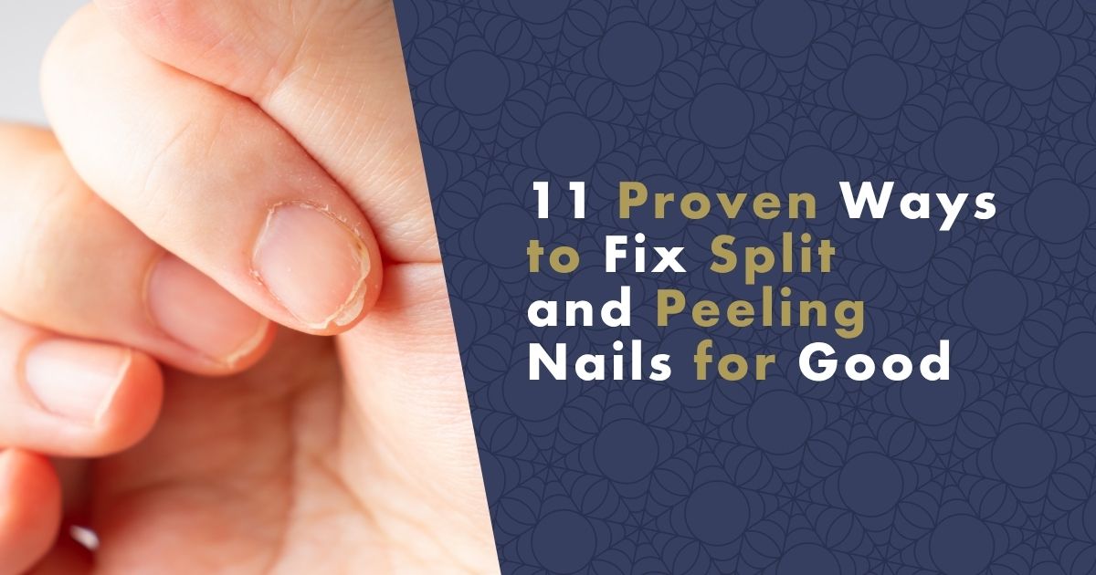 11-proven-ways-to-fix-split-and-peeling-nails-for-good-fb