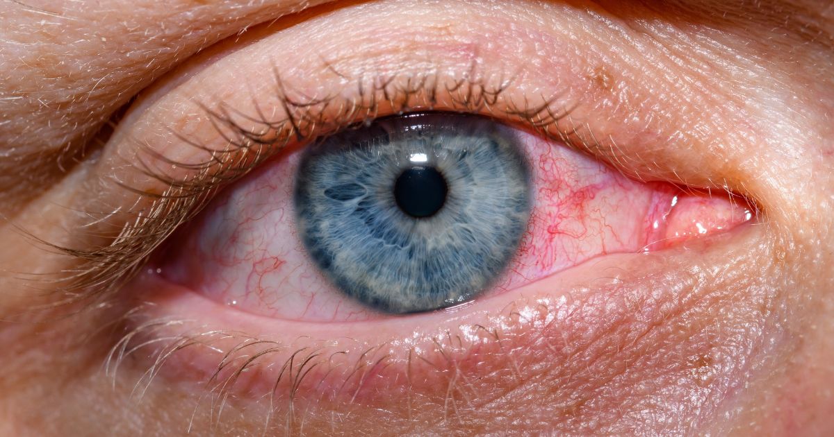 immune system response to allergens