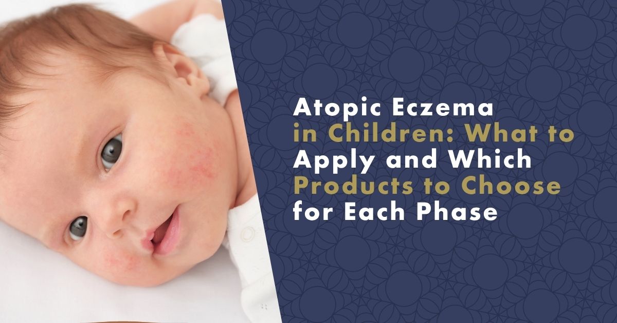 atopic-eczema-in-children-fb