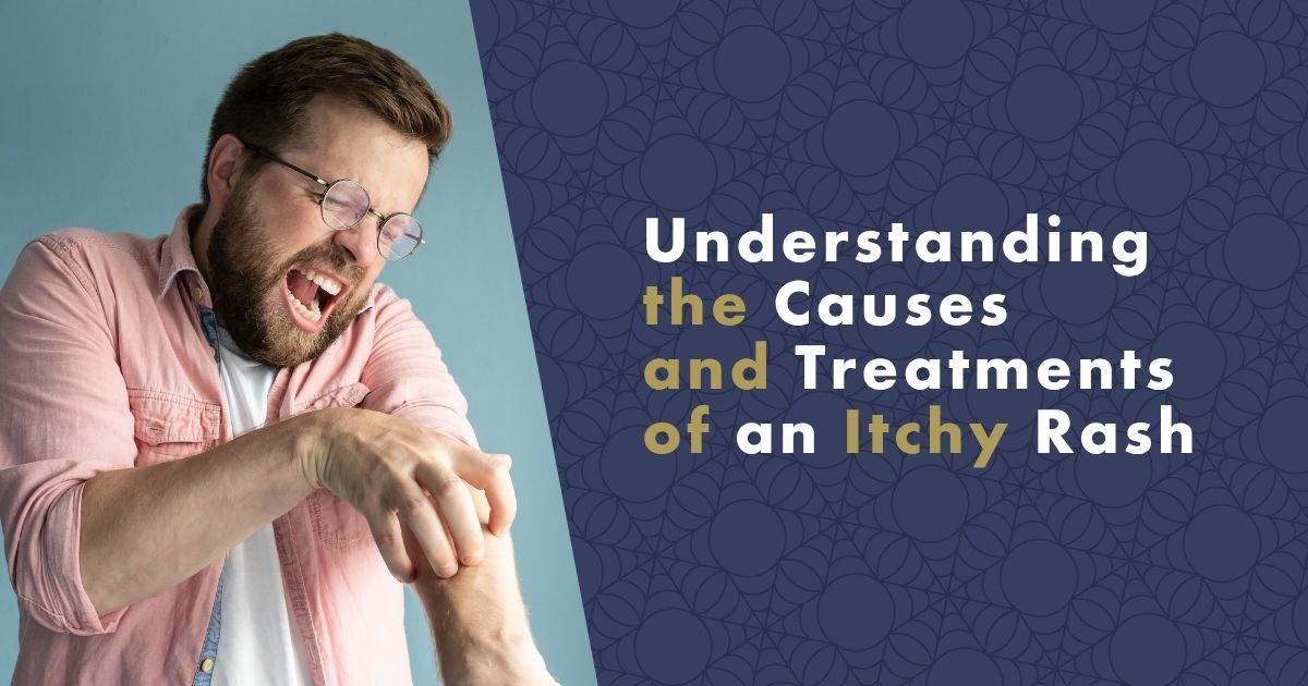 causes-and-treatments-of-an-itchy-rash-fb