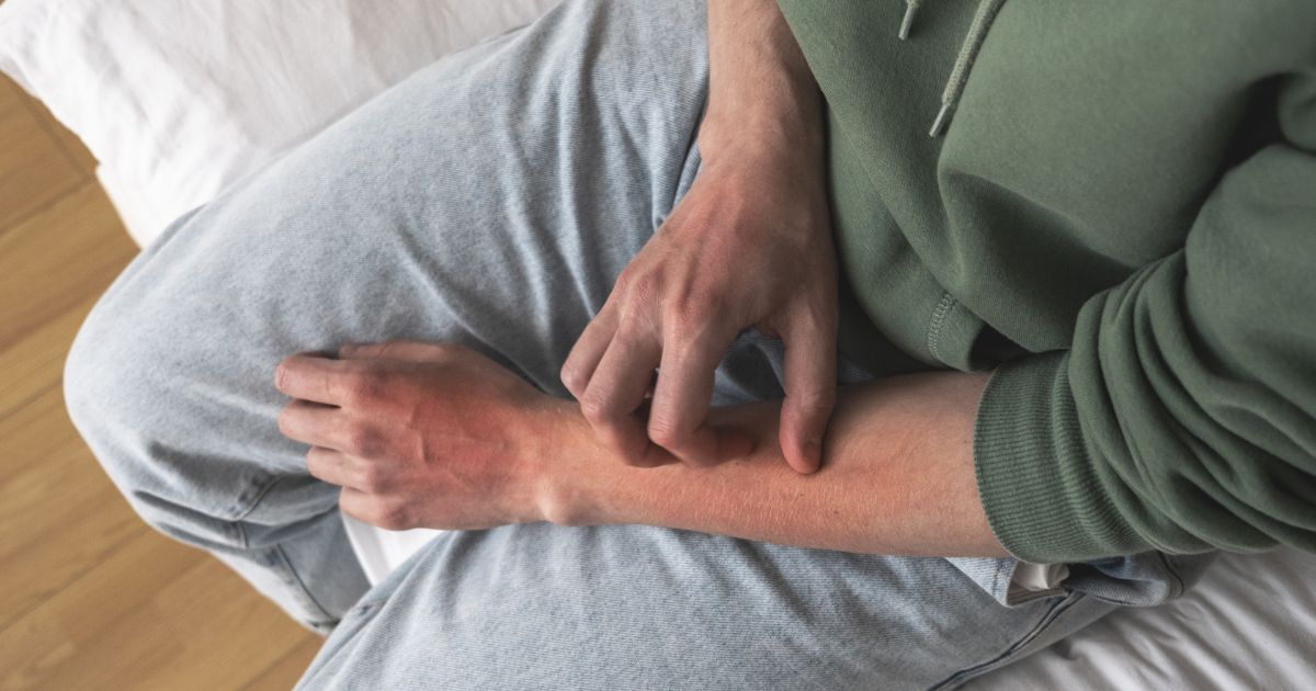 causes-and-treatments-of-an-itchy-rash