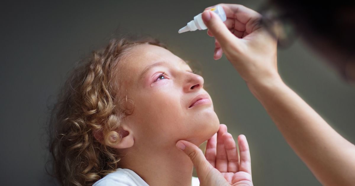 conjunctivitis-causes