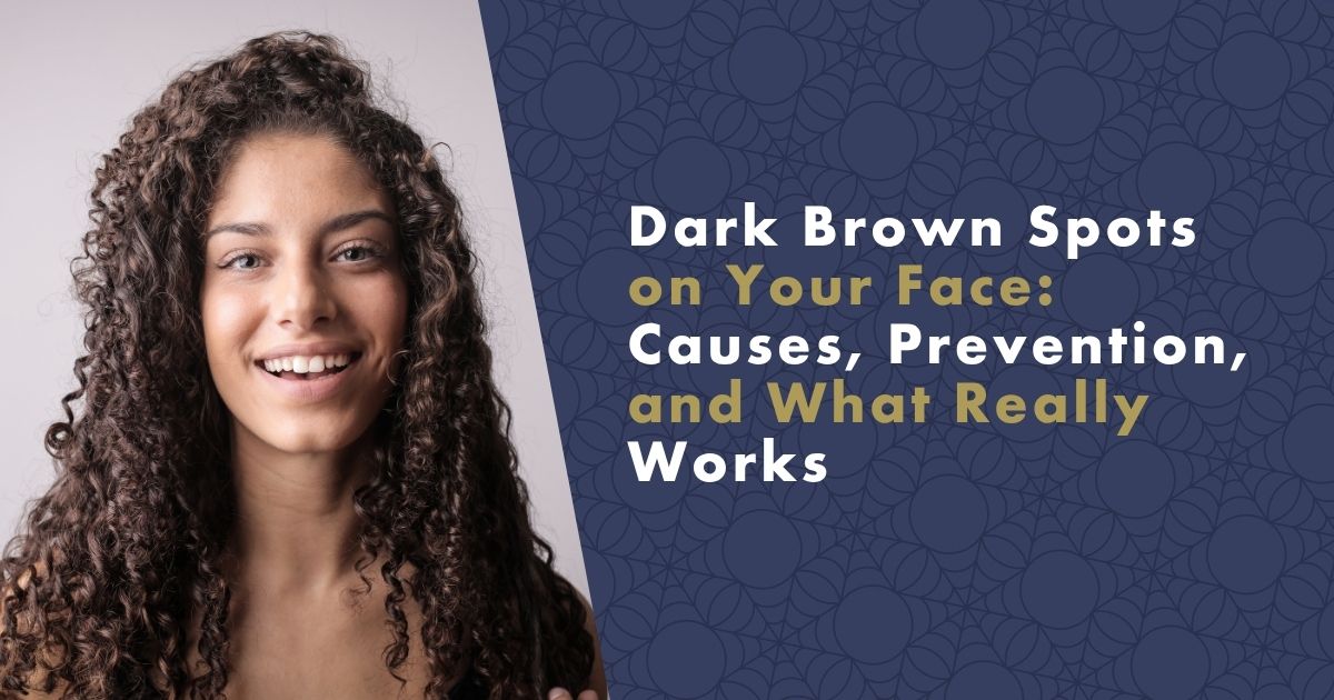 dark-brown-spots-fb