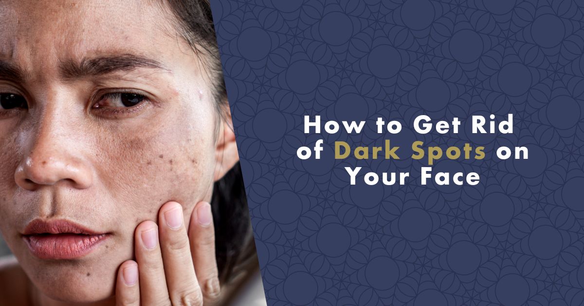 dark-spots-on-face-fb