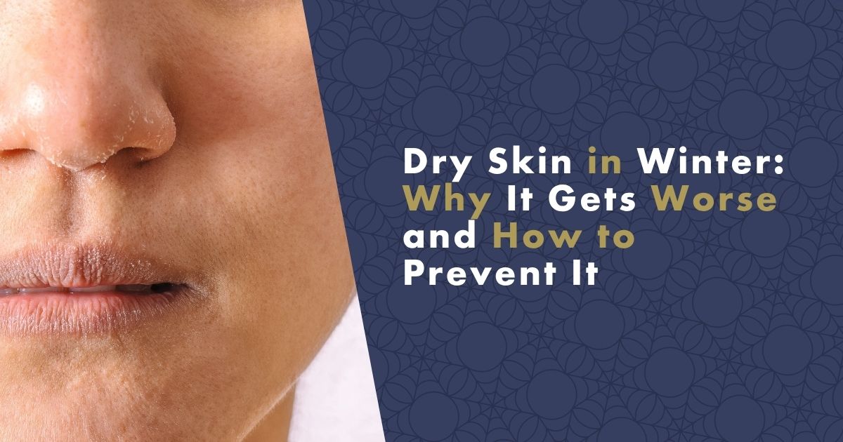 dry-skin-in-winter-fb
