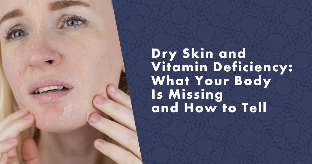dry-skin-vitamin-deficiency-fb