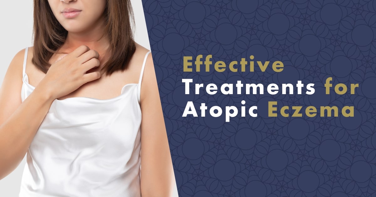 effective-treatments-for-atopic-eczema