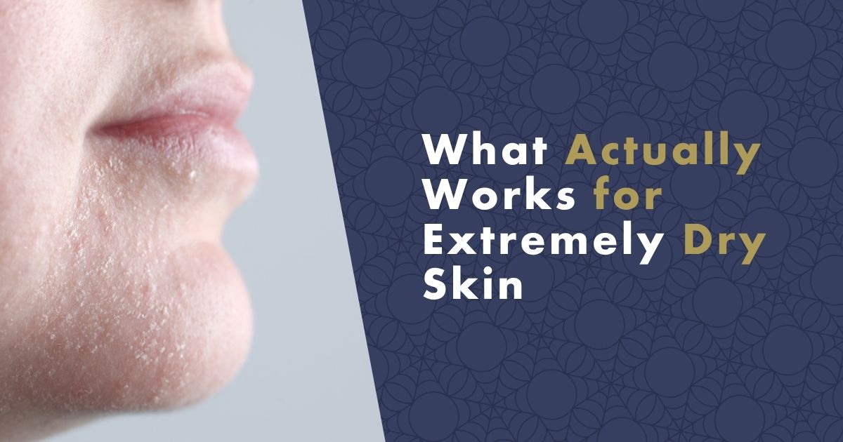 extremely-dry-skin-fb