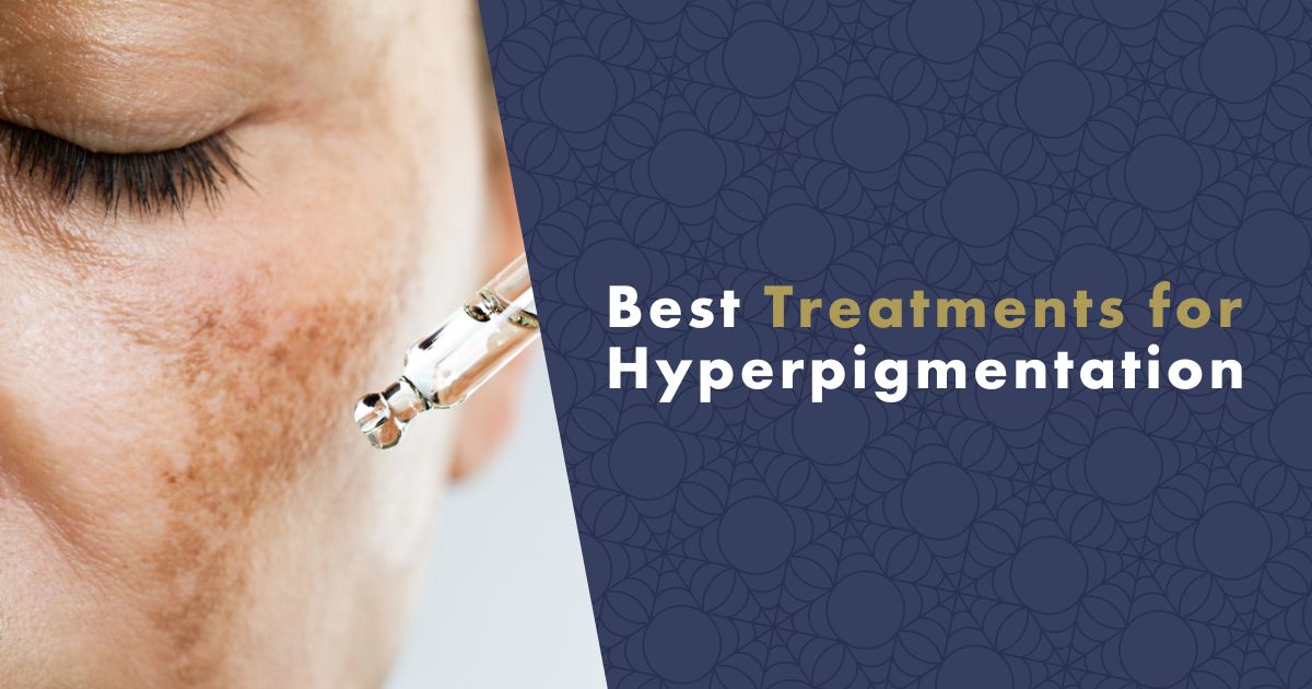 hyperpigmentation-fb