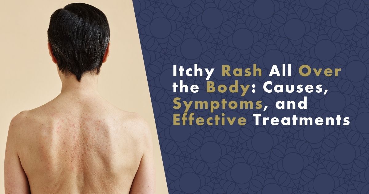 itchy-rash-all-over-the-body-fb