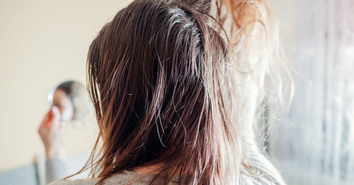 oily-hair