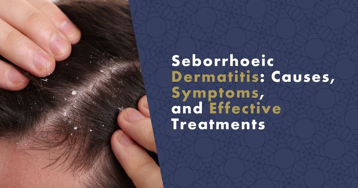 seborrhoeic-dermatitis-fb