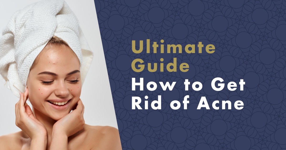 ultimate-guide-how-to-get-rid-of-acne-fb