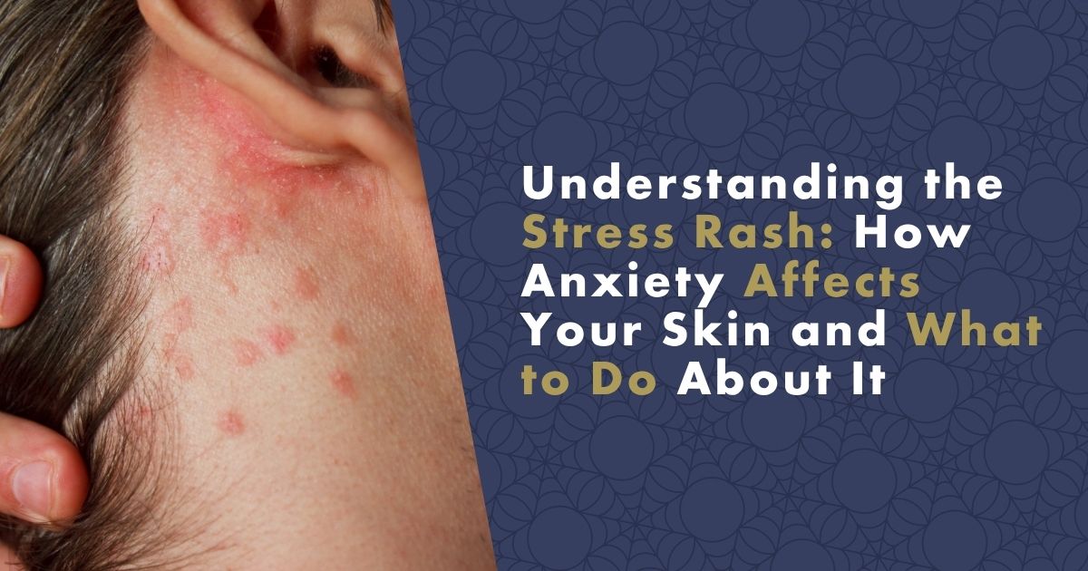 understanding-the-stress-rash-fb