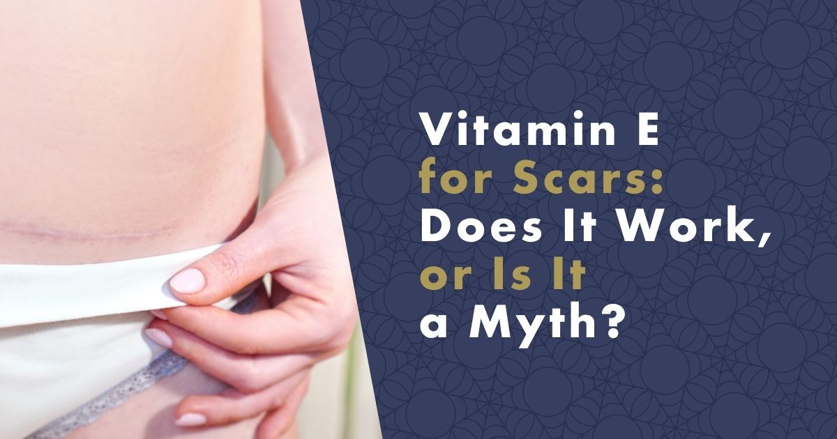 vitamin-e-for-scars-fb