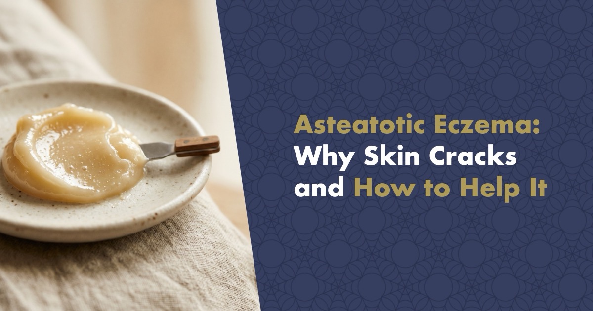 Asteatotic Eczema: Why Skin Cracks Like a Dried Riverbed and How to Help It