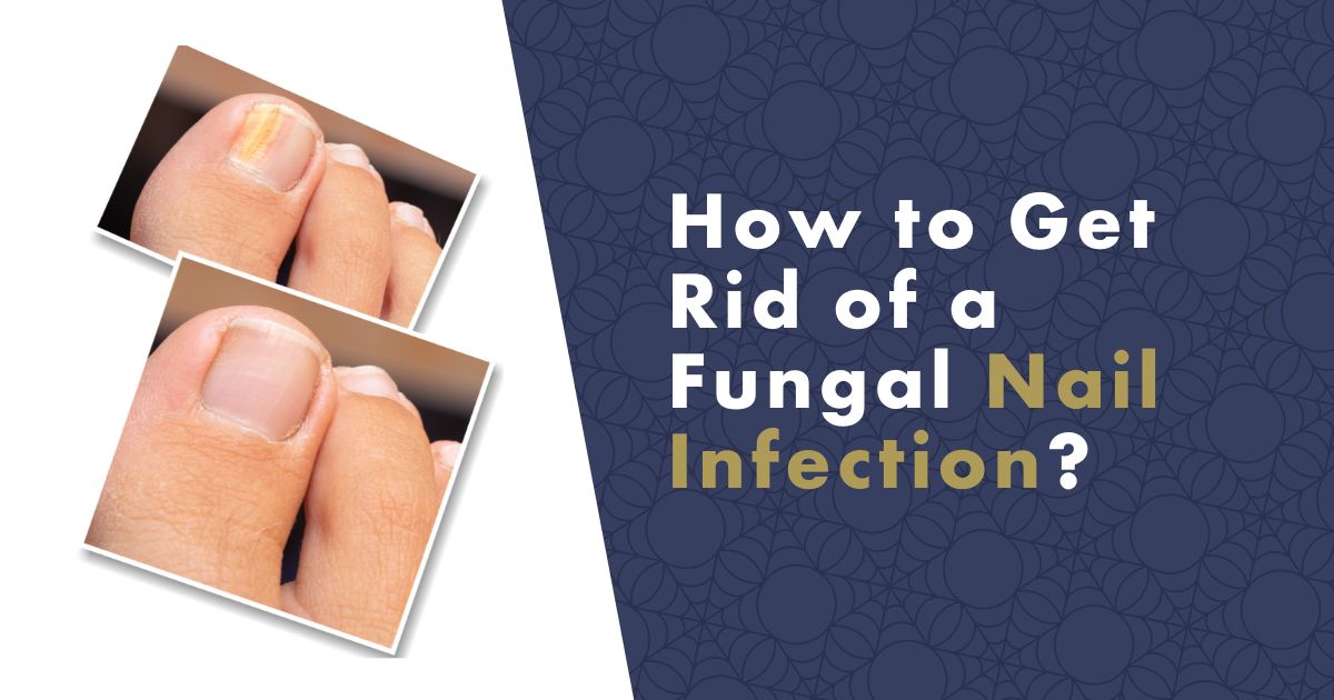 Over the counter nail fungus treatment deals