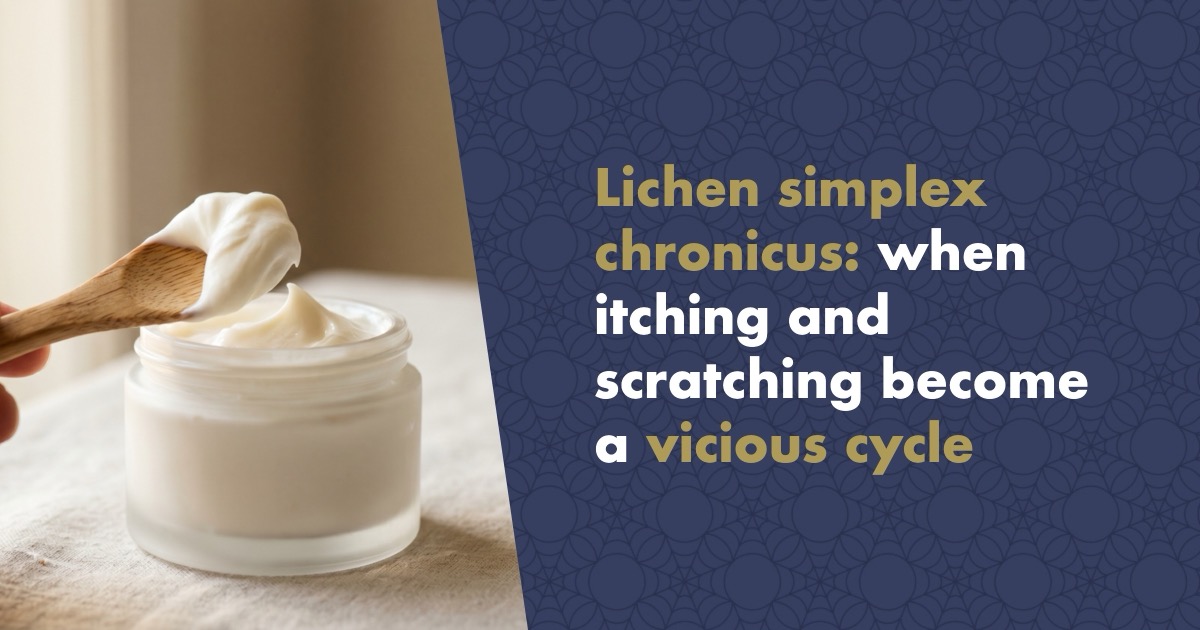 Lichen Simplex Chronicus (Neurodermatitis): When Itching and Scratching Become a Vicious Cycle