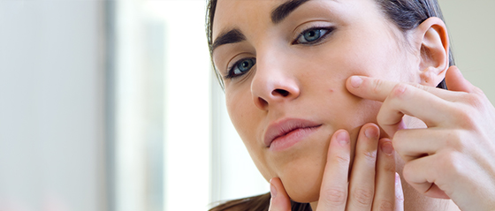 Akné a ich účinné odstránenie pomocou náplasti 